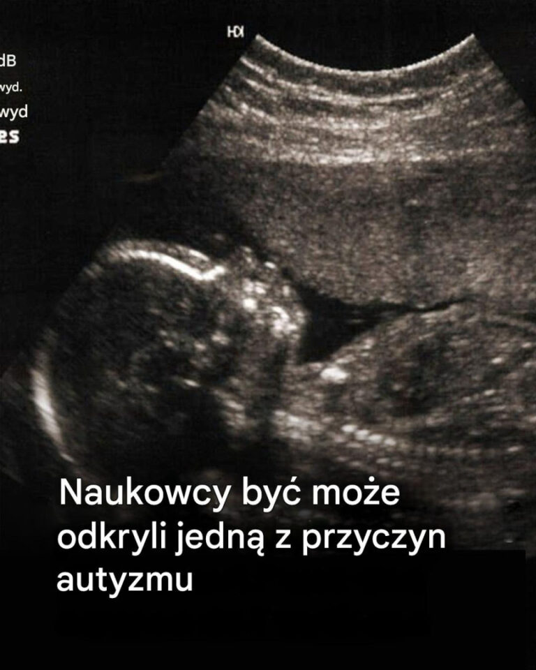 Bardzo interesujące!