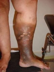 Ciche sygnały, które wysyła nasze ciało na długo przed tym, jak poczujemy się źle