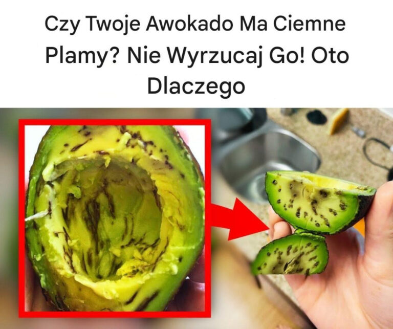 Czy Twoje Awokado Ma Ciemne Plamy? Nie Wyrzucaj Go! Oto Dlaczego 👇👇